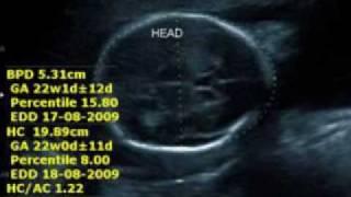 Week by week fetal development showing fetal development stages.mpg