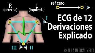 ECG de 12 Derivaciones Explicado, Animación.  Alila Medical Media Español.
