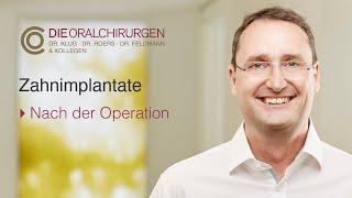 Zahnimplantate - nach der Operation (Dr. Daniel Klug)