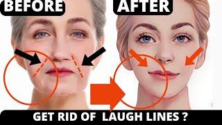 Effective Face Yoga to Remove Nasolabial Folds & Laugh Lines Naturally at Home! Frown Lines | 11 min