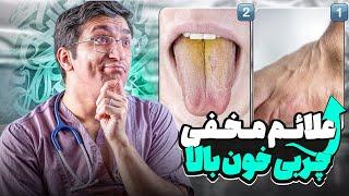 علائم مخفی چربی خون بالا