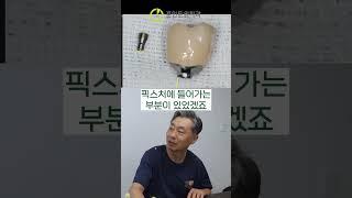 이제는 임플란트 수리의 시대