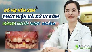 Harmful effects of extra teeth and damaged teeth - Everyone needs to know and take note