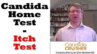 What Is The Itch Test For Candida? | Ask Eric Bakker