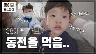 5살 아이가 동전을 먹음ㅣ내시경 후기ㅣ쭘이지부부