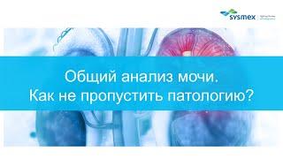 Общий анализ мочи - как не пропустить патологию?