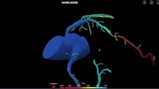 how cardiologist use FFR CT