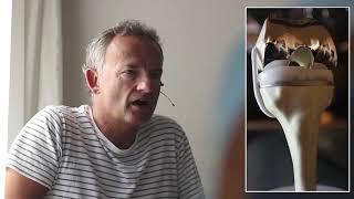 Conformis Patientenstory: Die Rückkehr zum Leben