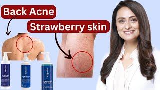 My Verdict on the Be Bodywise Bodycare Range for Back Acne & Strawberry Legs