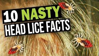 10 Facts You Don't Want to Know about Head Lice!