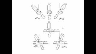 Angiographic views and equipment