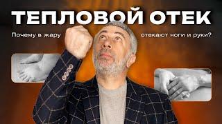 Отеки летом