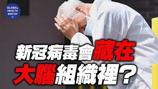 COVID-19 对于大脑和神经组织的影响 | 全球观察 | 林晓旭博士