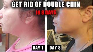 HOW TO GET RID OF A DOUBLE CHIN IN 8 DAYS | IT WORKS FAST!