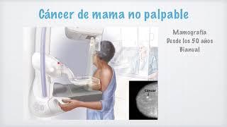 Cáncer de mama