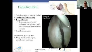 Arthroscopic Management of Hip Microinstability and Borderline Dysplasia