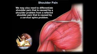 Shoulder Pain - Everything You Need To Know - Dr. Nabil Ebraheim