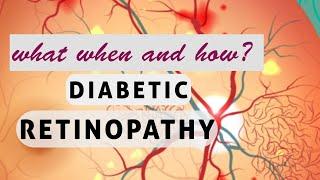 This will  change your perspective about DIABETIC RETINOPATHY!