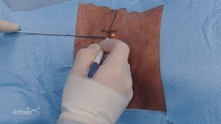 Endoscopic Approach to Transforaminal Discectomy