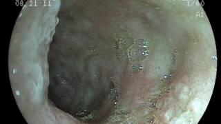 lymphoplasmacytic gastritis Dog