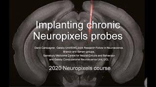 2020 Lecture 3.04 - Chronic Neuropixels implantation - Dario Campagner (UCL)