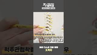 허리디스크 치료방법 딱 정리했습니다.