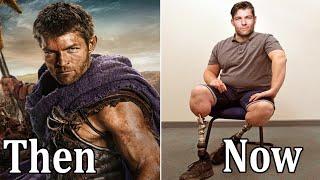 SPARTACUS 2010 Cast Then and Now 2022 How They Changed, Their Health Has Weakened A Lot