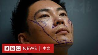 做美容手術的中國男人們：有人臉上動刀60次－ BBC News 中文