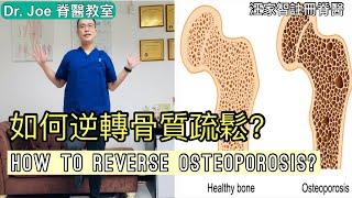 如何逆轉骨質疏鬆？ Dr Joe 教大家兩種方: 運動及營養[Eng Subtitles] How to Reverse Osteoporosis in 2 Steps.