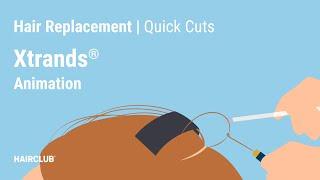 Check Out Xtrands by HairClub [Hair Loss Treatment Option]