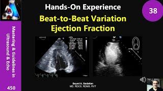 Hands-On Experience 38: Beat-to-Beat Variation & Ejection Fraction