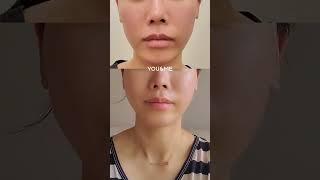 생기있는 바로 그 느낌 ‘실리프팅’으로 구현합니다