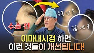 이마내시경을 하면 뭐가 좋아지나요?