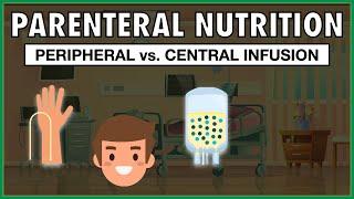 PPN vs. TPN