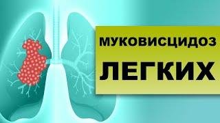 МУКОВИСЦИДОЗ. ЛЕЧЕНИЕ, СИМПТОМЫ, ДИАГНОСТИКА