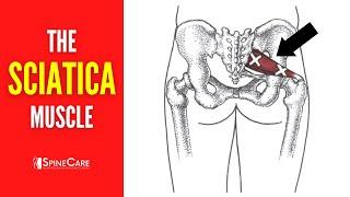 The Sciatica Muscle (How to Release It for INSTANT RELIEF)