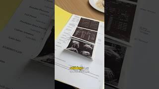 USG Fetomaternal di usia kandungan 31 weeks part 3 #usgfetomaternal #fetomaternal #pregnancy