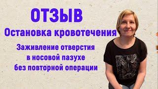 Микросферы помогли избежать повторной операции, устранив ошибки хирурга при установке имплантов.