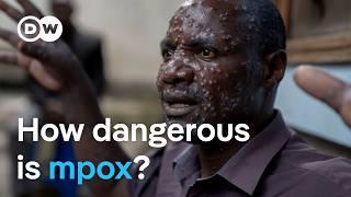 New mpox virus: Why is it spreading so quickly? | DW News