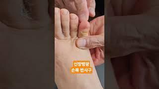 신장방광 손목 반사구