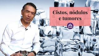 CISTOS, NÓDULOS E TUMORES NA MEDICINA CHINESA - EP.#7