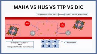 MAHA vs HUS vs TTP vs DIC