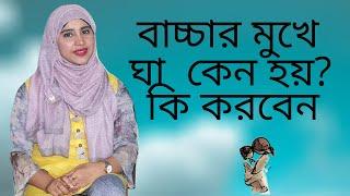 বাচ্চার মুখে ঘা কেন হয়, কি করবেন? Nutritionist Aysha Siddika | Kids and Mom