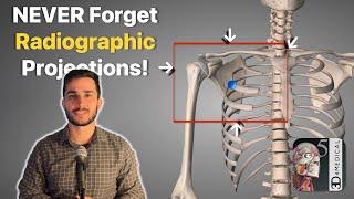 How I NEVER Forget Radiographic Projections