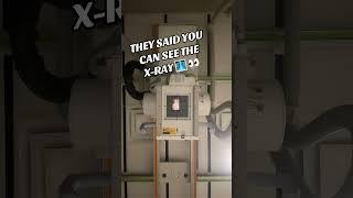 PEOPLE SAID YOU CAN SEE THE X-RAYS 🩻… DID YOU SEE IT⁉️️