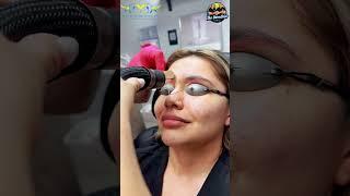 Microbladed Eyebrows Treated w Laser️Tattoo Removal by Dr. H.L. Greenberg at Las Vegas Dermatology®