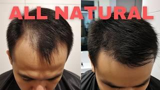 How To Stop Hair Loss Naturally - Top 3 Options