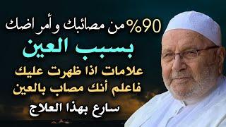 90 %من مصائبك وأمراضك بسبب العين علامات إن ظهرت عليك فاعلم أنك محسود ..الشيخ محمد راتب النابلسي