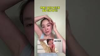 #리프팅효과 #동안 #탄력#주름#리프팅#중안부