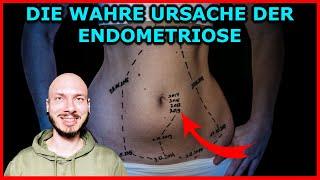 Die WAHRE Ursache der ENDOMETRIOSE - Es ist NICHT die GEBÄRMUTTERSCHLEIMHAUT betroffen